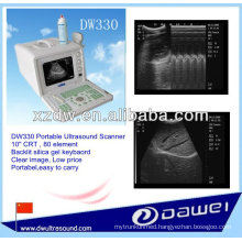 2d portable full digital ultrasound scanner